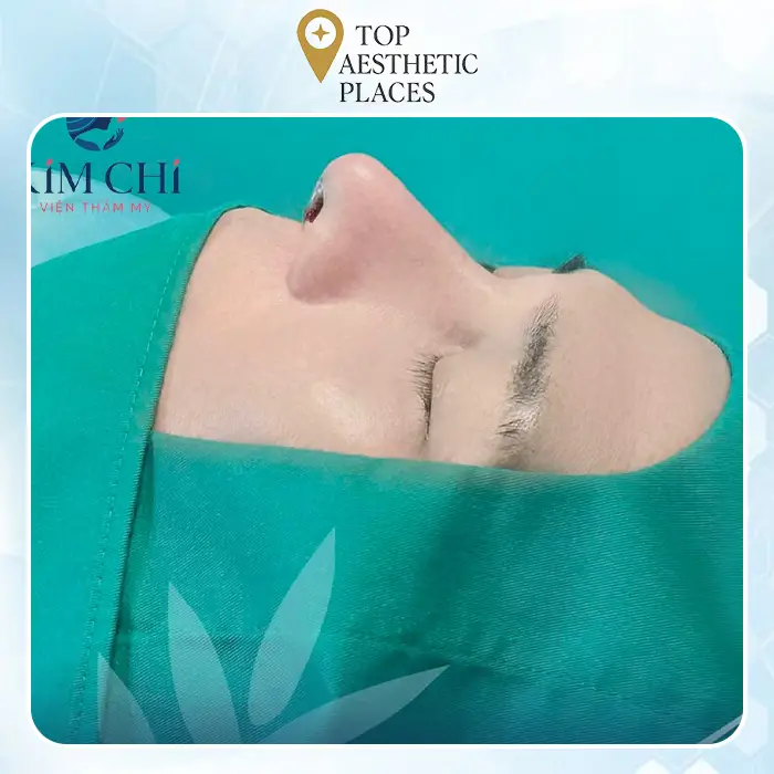 Ra mắt 7+ Trung tâm phẫu thuật thẩm mỹ mũi uy tín và an toàn hàng đầu tại Bình Dương năm 2024