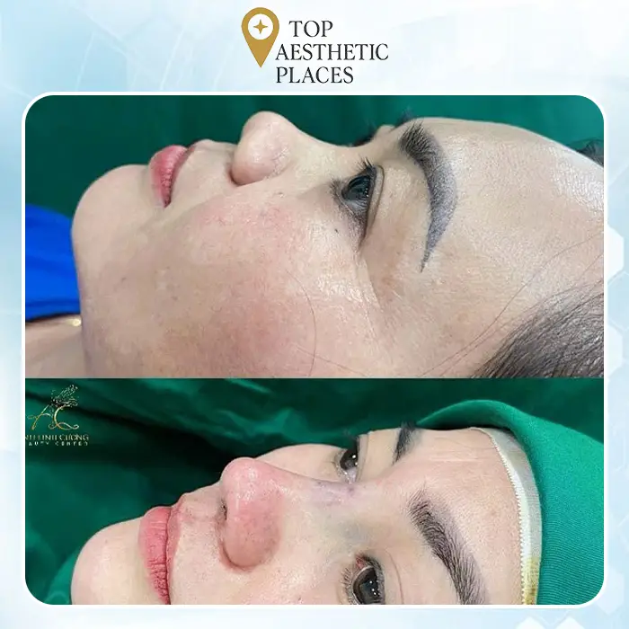 Unveiling the Premier 7 Rhinoplasty Clinics in Bà Rịa – Vũng Tàu