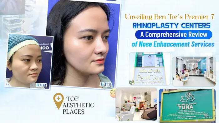 Unveiling Ben Tre’s Premier 7 Rhinoplasty Centers: A Comprehensive Review of Nose Enhancement Services