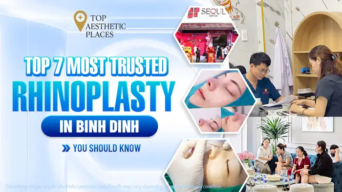 Top 7 Most Trusted Rhinoplasty in Binh Dinh You Should Know
