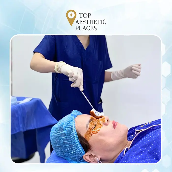 Phẫu thuật mũi tại Hưng Yên: 7 phòng khám uy tín bạn nên biết