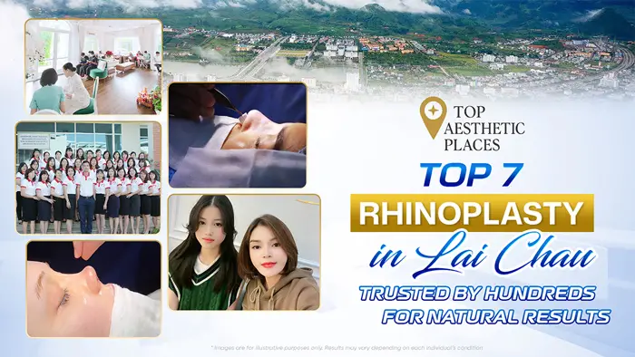 Top 7 Rhinoplasty in Lai Châu — Trusted by Hundreds for Natural Results