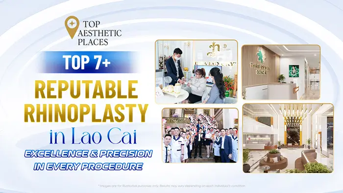 Top 7+ Reputable Rhinoplasty in Lào Cai — Excellence & Precision in Every Procedure