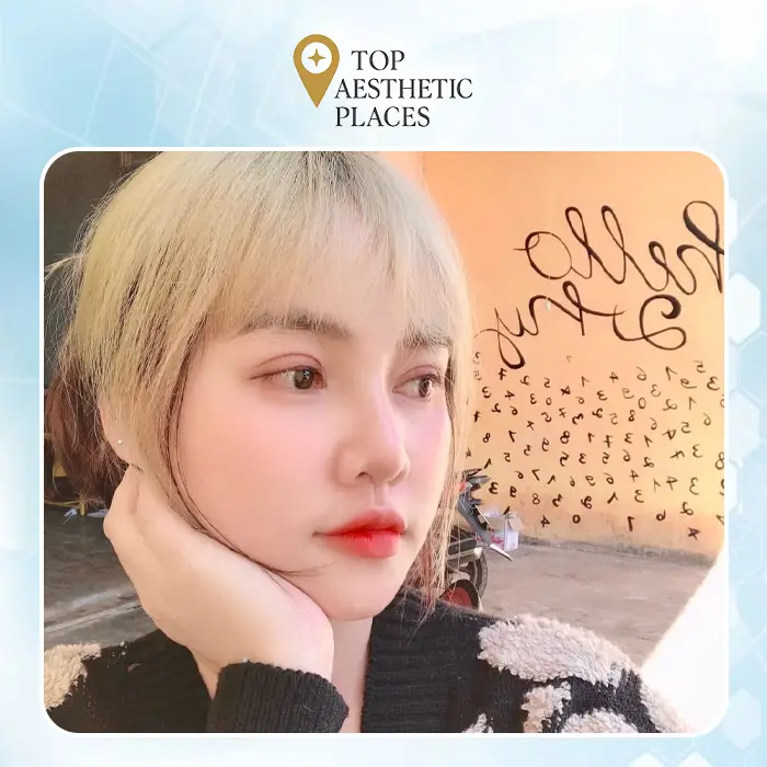 Unveiling the Premier 7 Rhinoplasty in Quang Binh: Trusted & Professional Options