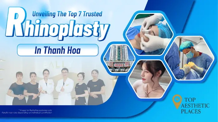 Unveiling the Top 7 Trusted Rhinoplasty in Thanh Hoa