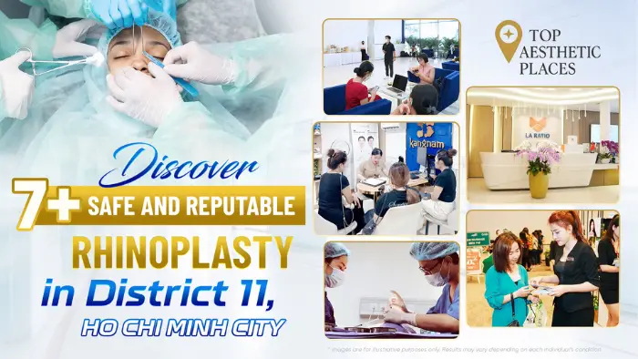 Discover 7+ Safe and Reputable Rhinoplasty in District 11, Ho Chi Minh City