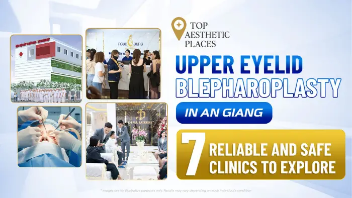 Upper Eyelid Blepharoplasty in An Giang: 7 Reliable and Safe Clinics to Explore