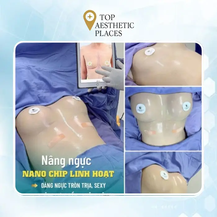 Top 5 trusted breast augmentation providers in An Giang