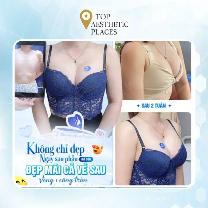 Top 5 reputable breast augmentation in Ho Chi Minh City