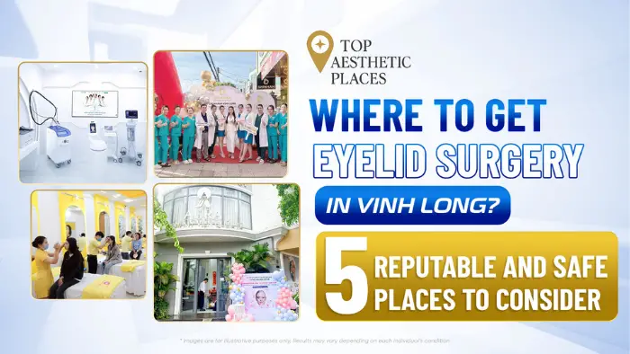 Where to get eyelid surgery in Vinh Long? 5 reputable and safe places to consider