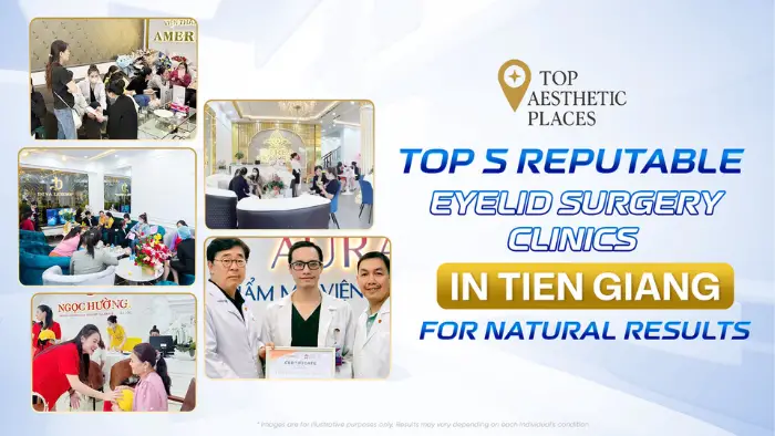 Top 5 Reputable Eyelid Surgery Clinics in Tien Giang for Natural Results