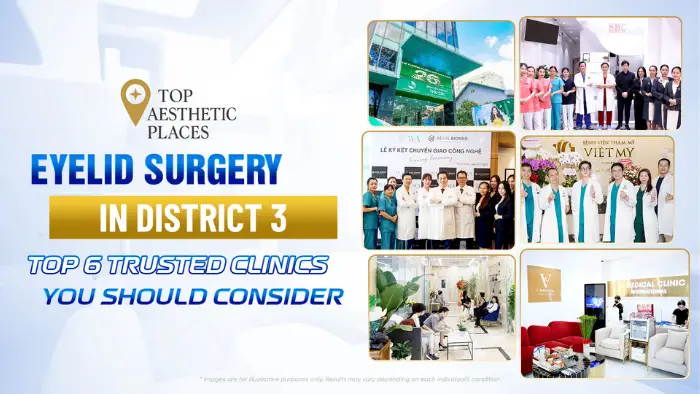 Eyelid Surgery in District 3: Top 6 Trusted Clinics You Should Consider