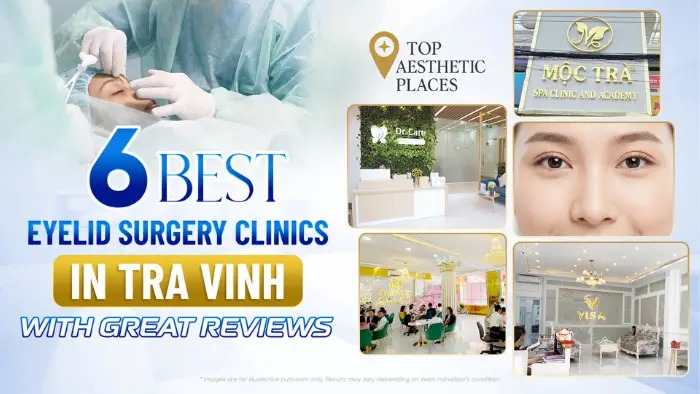 List of 7 reputable double eyelid surgery clinics in Tuyen Quang for natural results