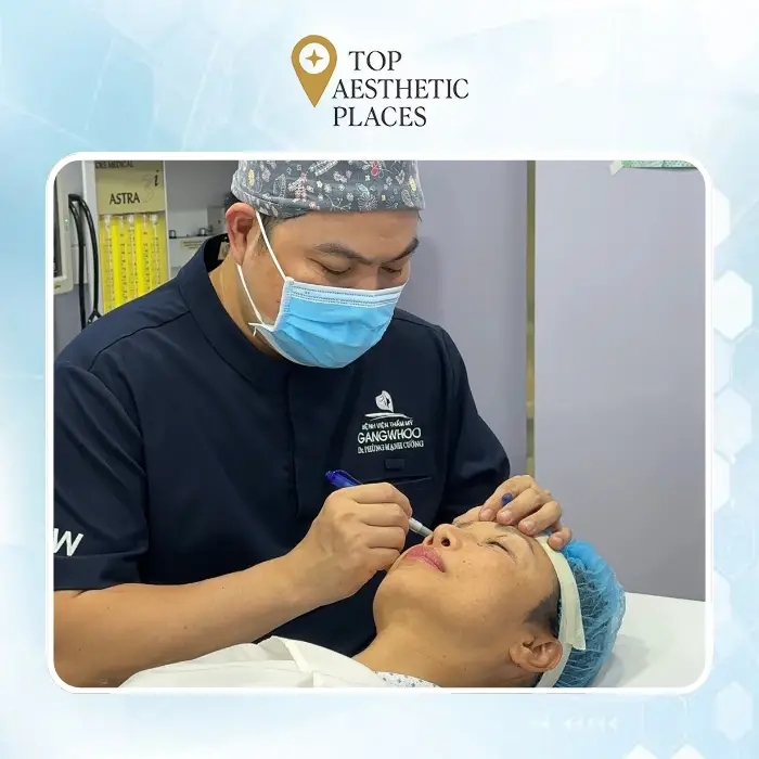 Eyelid Surgery in Tan Binh District: Detailed Guide and 6 Trusted Addresses