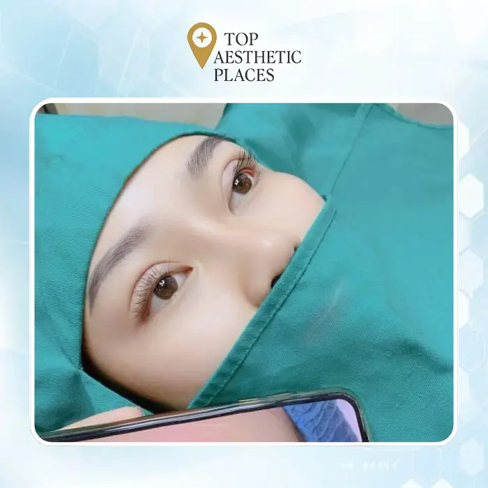 Review of 4 Beautiful and Natural Eyelid Surgery Addresses in Tan Phu District