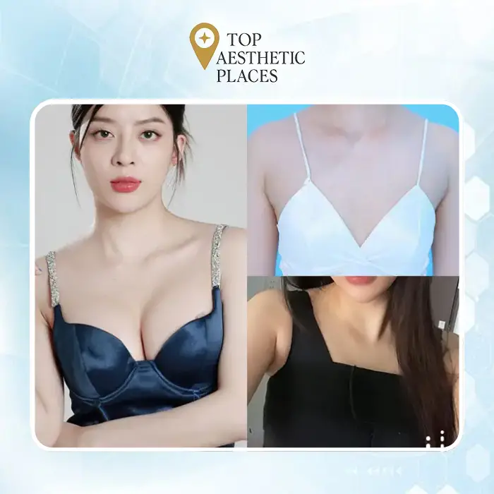 Best Places for Breast Augmentation in Lam Dong: 6+ Trusted Options