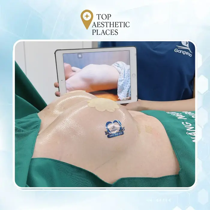 Breast Augmentation in Tien Giang: Top 6 Clinics Worth Considering