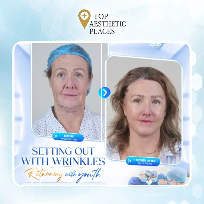 Looking for a Facelift in Ca Mau? Here Are 5 Clinics to Explore