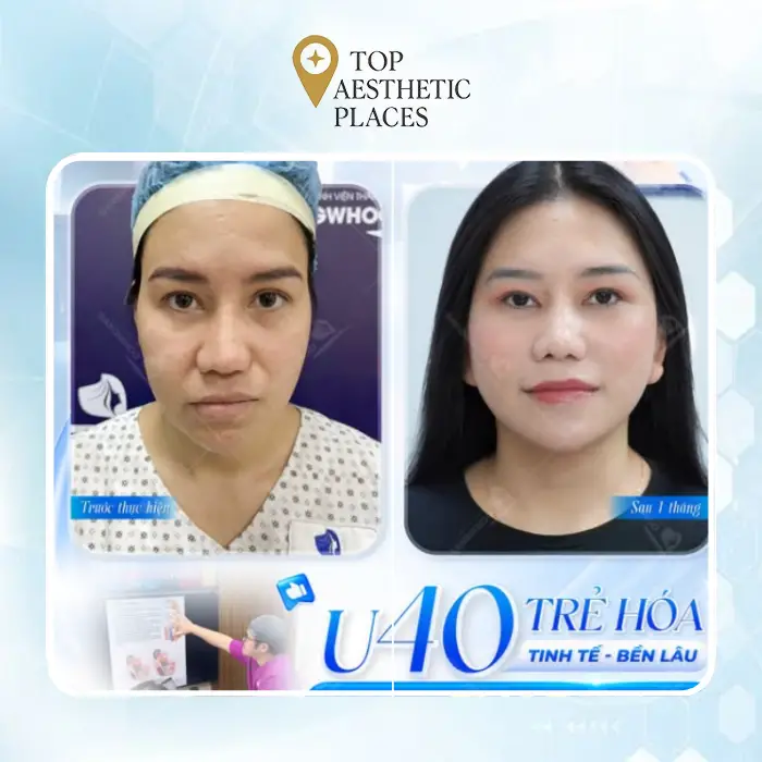 Explore the Top 5 Facelift Clinics in Dong Thap