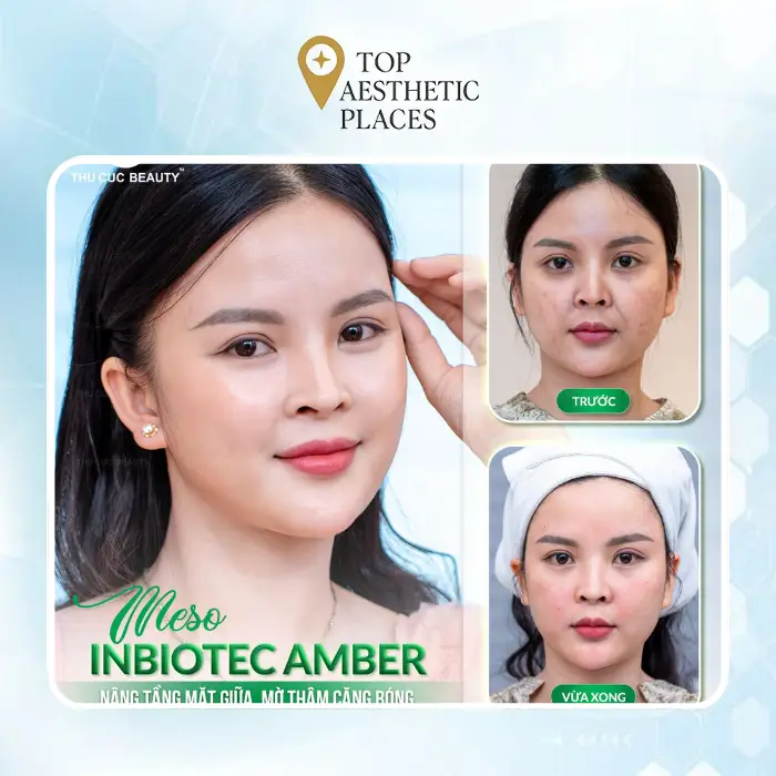 Discover 7 Leading Facelift Clinics in Hanoi