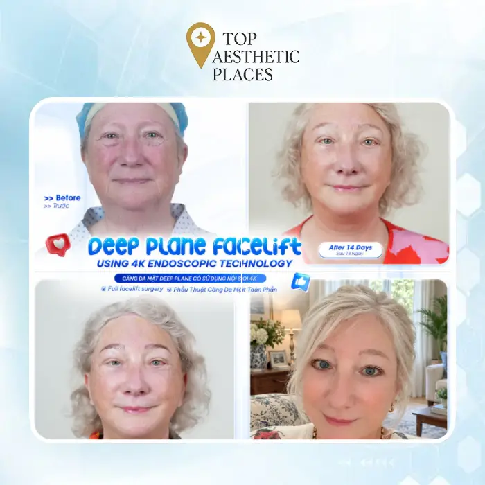 Explore the Top 4 Facelift Clinics in Ha Giang