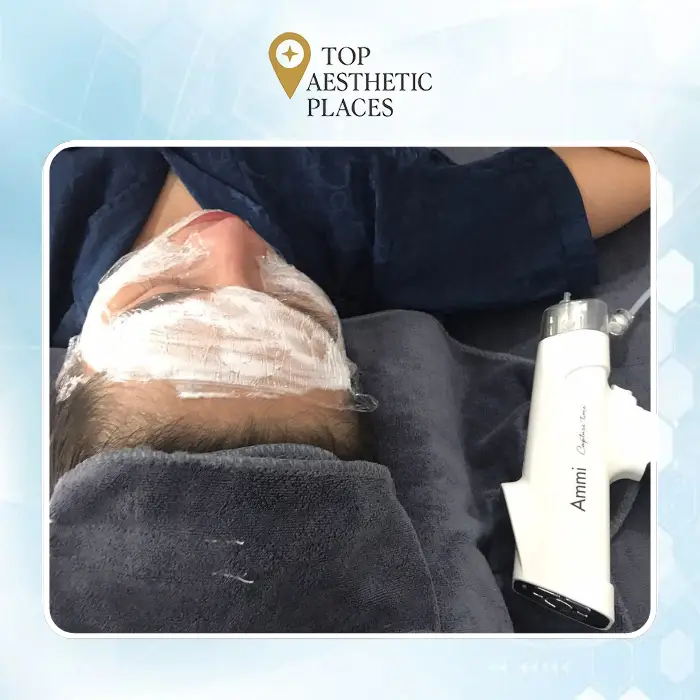 Facelift in Tay Ninh: A Guide to 4 Skin Rejuvenation Clinics 