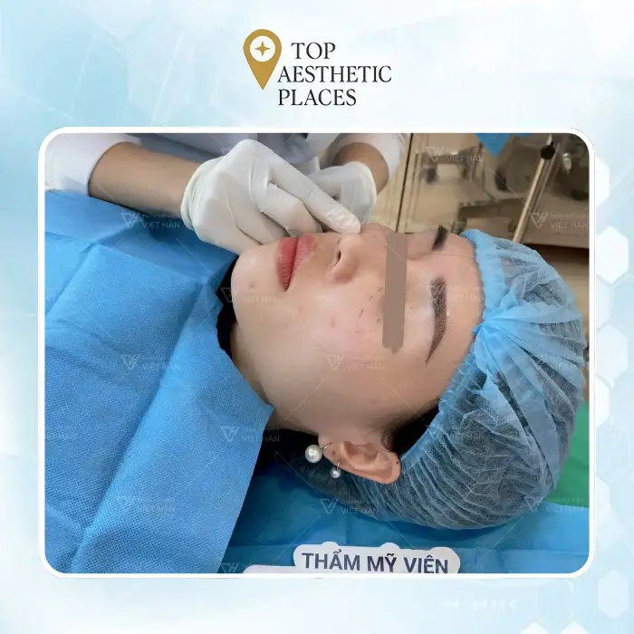 Facelift in Thanh Hoa Discover 7 Skin Rejuvenation Clinics