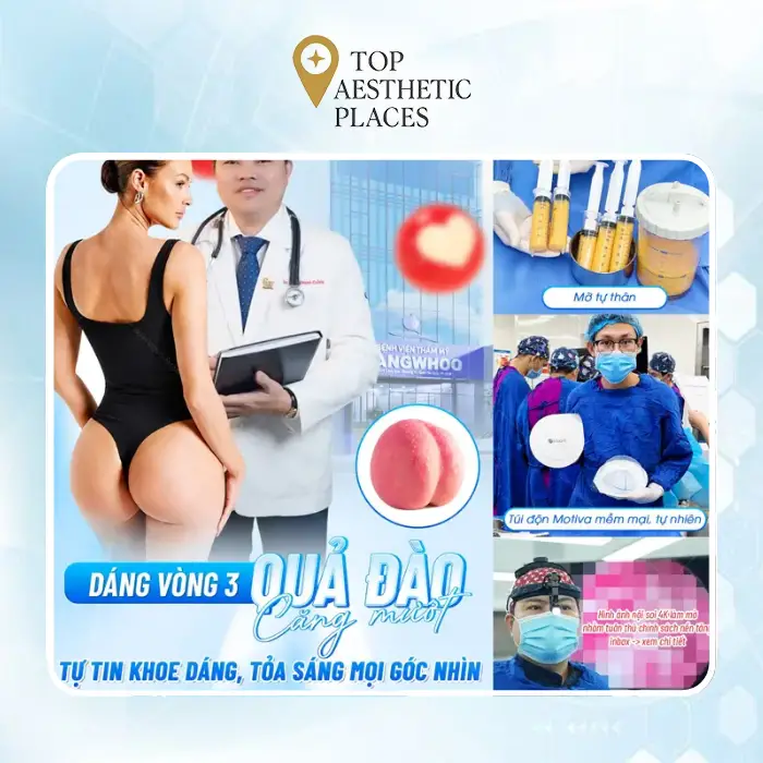 Buttock Augmentation in District 1 – 7 Facilities to Consider
