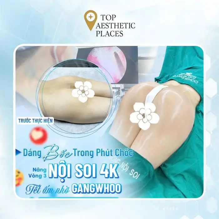 Buttock Augmentation Near Nam Dinh – 4 Clinics to Consider